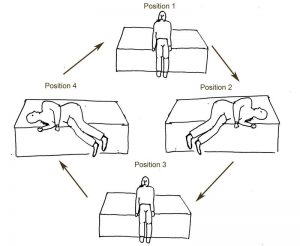 BPPV – Ear, Balance and Eustachian Tube